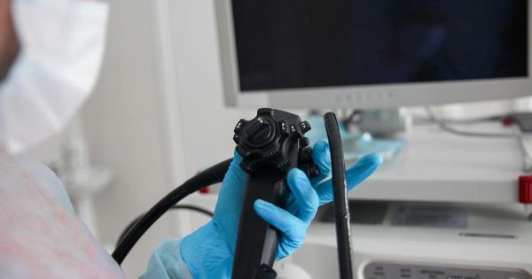一项新的研究质疑结肠镜检查的有效性