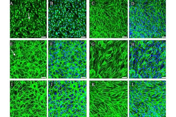 From hagfish to membrane: Modeling age-related macular degeneration